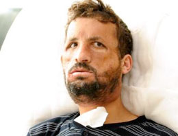 Yüz ve kol naklinden sonra kimlik nakli