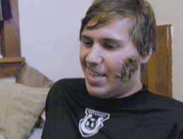 Bir ısırık hayatını mahvetti